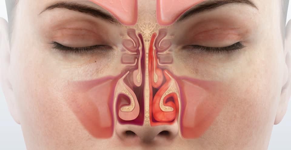 Симптомы привыкания к каплям в нос
